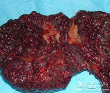 星空综合:天津新建3座高楼刚封顶拟拆除 开发商为贪官之子(图3) 星空·综合体育